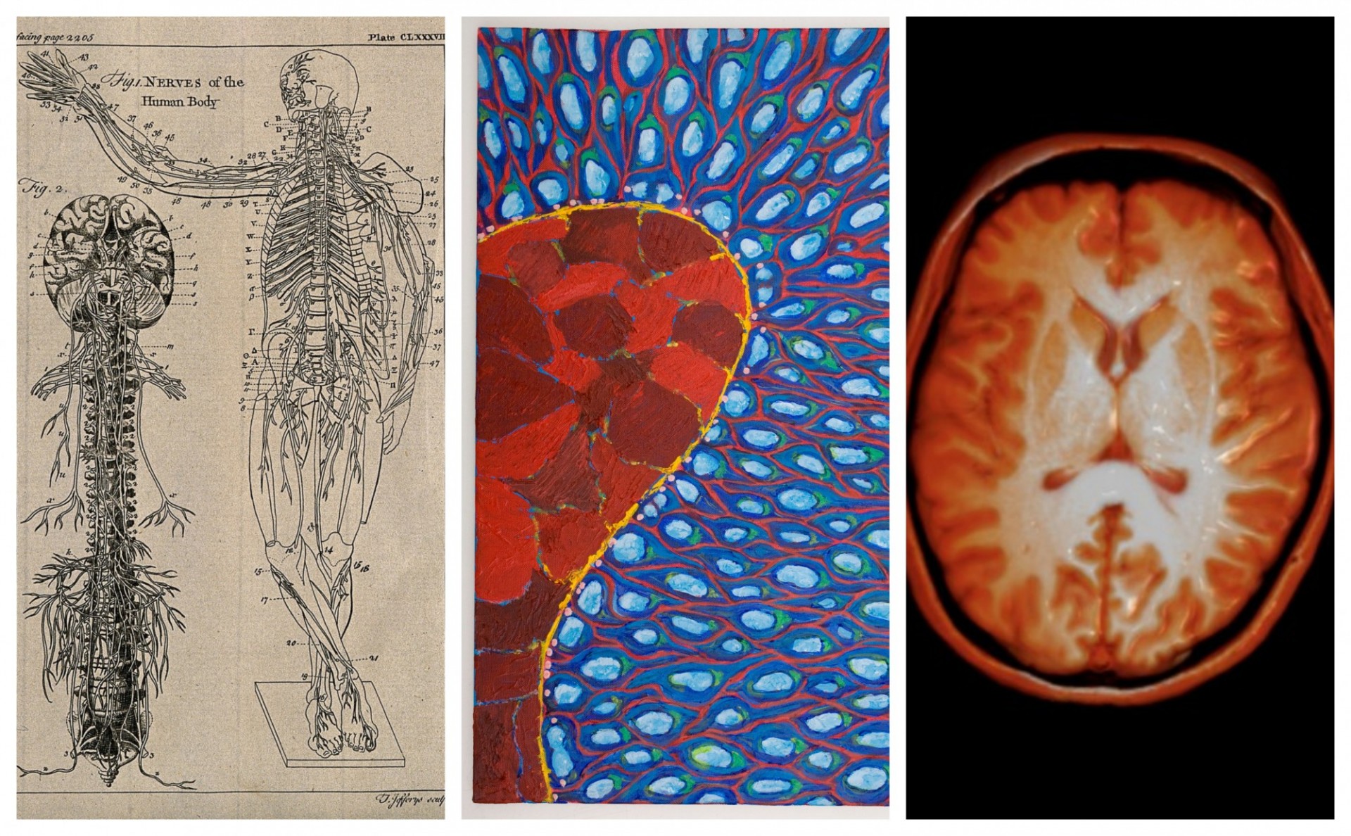 Wellcome Collection images of the brain and nervous system